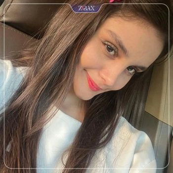 عکس جراحی زیبایی بینی توسط دکتر احسان شفیعی در تهران