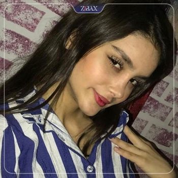 نمونه جراحی زیبایی بینی با دکتر احسان شفیعی جراح بینی تهران