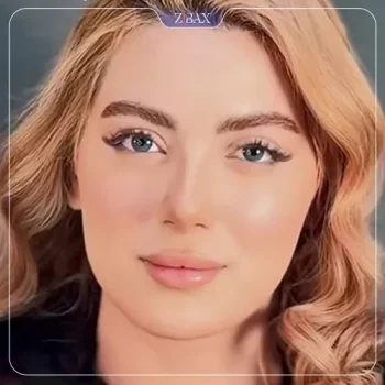 نمونه کارهای دکتر جواد خالقی جراح بینی