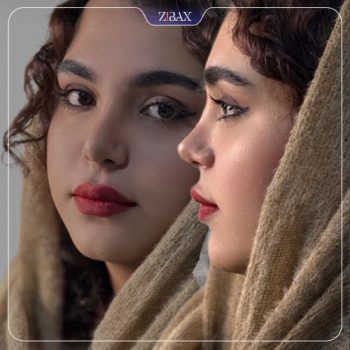 نمونه جراحی زیبایی بینی با دکتر محرابی شیراز