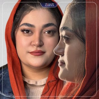 نمونه کار عمل زیبایی بینی دکتر فرهاد محرابی شیراز