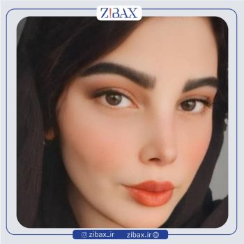 نمونه عمل زیبایی بینی دکتر امید زرگرانی جراح بینی در شیراز