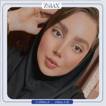 نمونه عمل بینی با دکتر مریم بحری جراح زیبایی بینی تهران