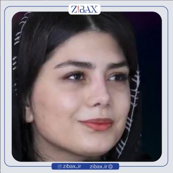 جراحی بینی زنانه با دکتر حامد عباسی