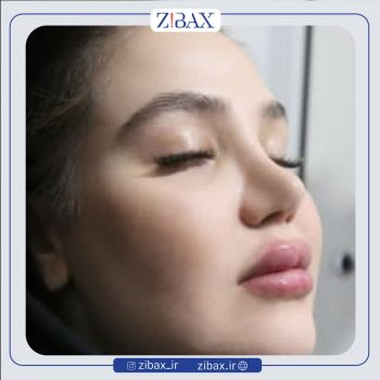 عمل بینی به سبک دکتر احمد زمانیان