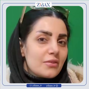 جراحی راینوپلاستی بینی با دکتر وحید موحد