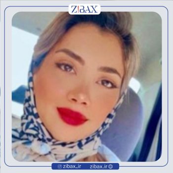 نمونه جراحی نیمه فانتزی بینی با دکتر پریسا قاسمی