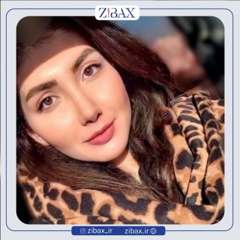 نمونه جراحی بینی با دکتر پریسا قاسمی