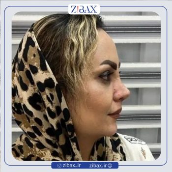 جراحی دماغ به سبک طبیعی با دکتر مهرداد جعفری