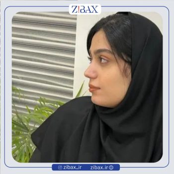 جراحی زیبایی بینی با دکتر مهرداد جعفری