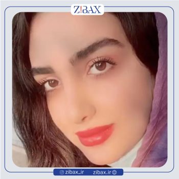 نمونه کار عمل بینی با دکتر سعیدرضا توفیقی جراح بینی شیراز