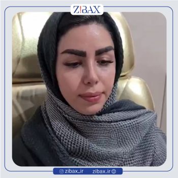 نمونه عمل زیبایی بینی دکتر عطاالله غفاری تهران