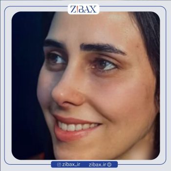 جراحی دماغ با دکتر نرگس میکانیکی