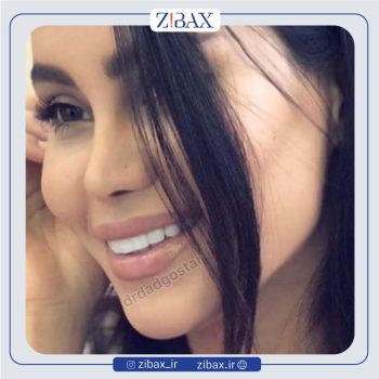 عمل بینی طبیعی با دکتر علیرضا دادگستر