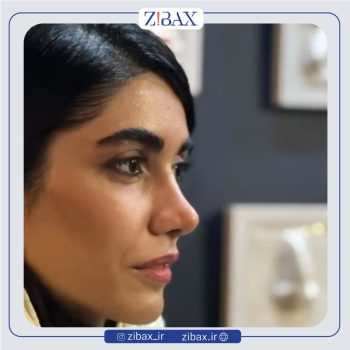 جراحی زیبایی بینی با دکتر نرگس میکانیکی