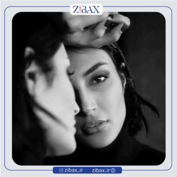 نمونه کار عمل بینی با دکتر وحیده درتاج جراح بینی تهران