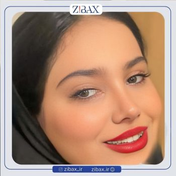 جراحی بینی دخترانه با دکتر مجتبی قائدی