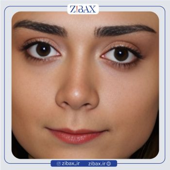 نمونه جراحی بینی با دکتر هرمز بازیاری دلاور جراح بینی تهران