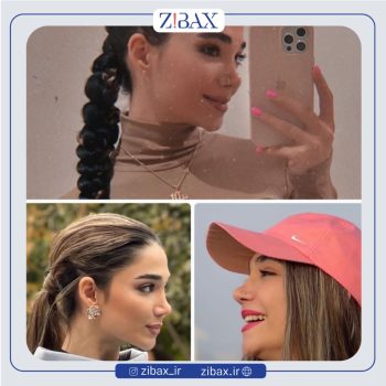 نمونه کار جراحی بینی با دکتر مرتضی جوادی جراح بینی تهران