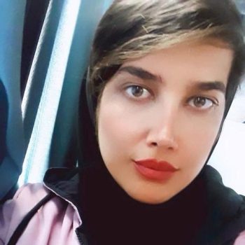 نمونه کار دکتر امید زرگرانی جراح بینی در شیراز با مشاوره زیباکس