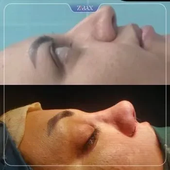 نمونه کار دکتر سعدالله صمدی کرمان
