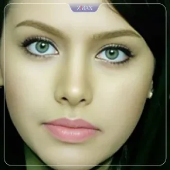 نمونه کار عمل بینی دکتر هرمز بازیاری