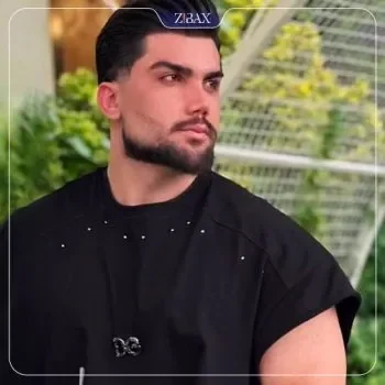 نمونه کار عمل بینی دکتر خسرو خسروی