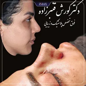 نمونه کار دکتر کورش قنبر زاده جراح بینی