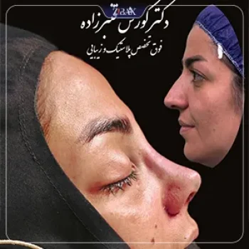 نمونه کار دکتر کورش قنبرزاده فرد