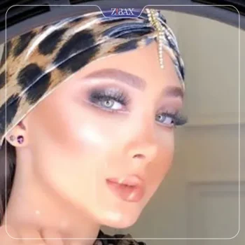 نمونه کار دکتر میترا علامه جراح بینی