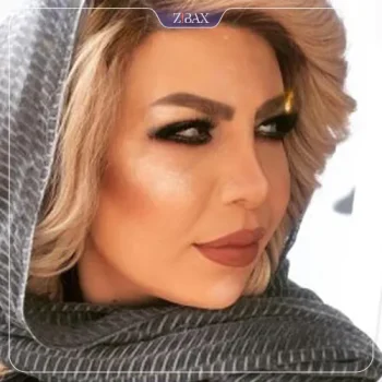 نمونه کار عمل بینی دکتر میترا علامه
