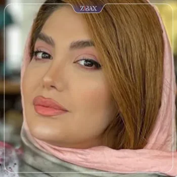 نمونه کار دکتر علامه جراح بینی
