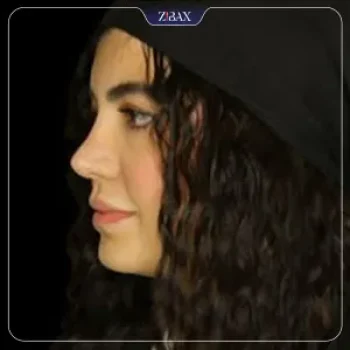 نمونه کار دکتر رضا بدیعی