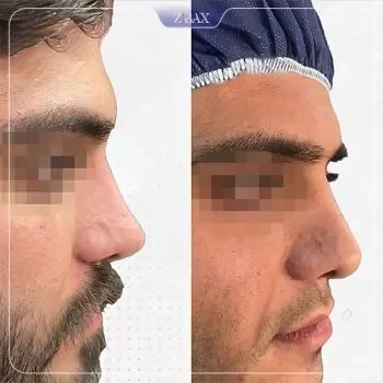 نمونه کار دکتر عین آبادی شیراز