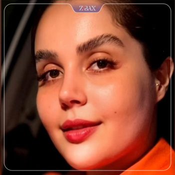 نمونه جراحی بینی دکتر محمودرضا اصحاب یمین
