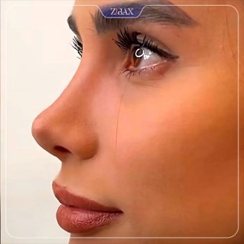 نمونه عمل بینی با دکتر محمد باقر بخشی پور شیراز