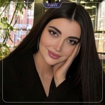 نمونه جراحی بینی توسط دکتر نیما برادران