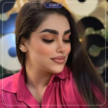 نمونه جراحی بینی توسط دکتر نیما برادران