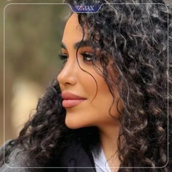 نمونه جراحی بینی توسط دکتر نیما برادران