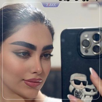 نمونه جراحی بینی توسط دکتر نیما برادران