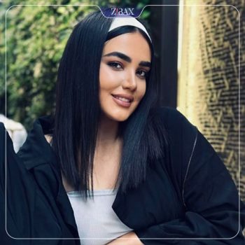 نمونه جراحی بینی توسط دکتر نیما برادران