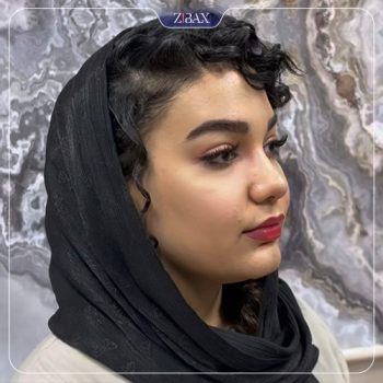 نمونه جراحی زیبایی بینی دکتر مهدی لبیبی