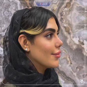 نمونه جراحی زیبایی بینی دکتر مهدی لبیبی
