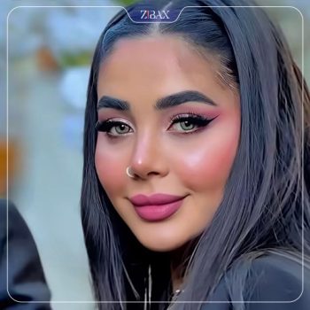 عمل زیبایی بینی با دکتر ماندانا فاوجی در تهران