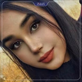 نمونه جراحی زیبایی بینی توسط دکتر ماندنا فاوجی در تهران