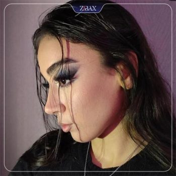 نمونه عمل زیبایی بینی دکتر یاسر نصوری