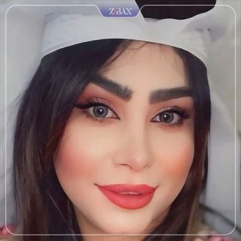 نمونه کار جراحی بینی دکتر کاظم رشته احمدی در شیراز