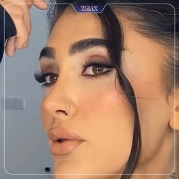 نمونه جراحی زیبایی بینی با دکتر رشته احمدی شیراز