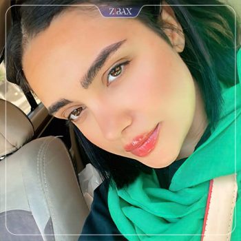 عکس نمونه کار جراحی بینی با دکتر محمد اسماعیل کوشش در شیراز