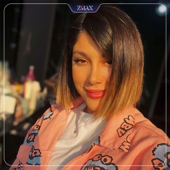 نمونه جراحی بینی با دکتر محمد اسماعیل کوشش در شیراز